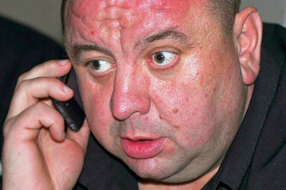 Экс-супруга Оксаны Ткаченко задержали по подозрению в избиении собственной дочери Экс-супруга Оксаны Ткаченко задержали по подозрению в избиении собственной дочери
