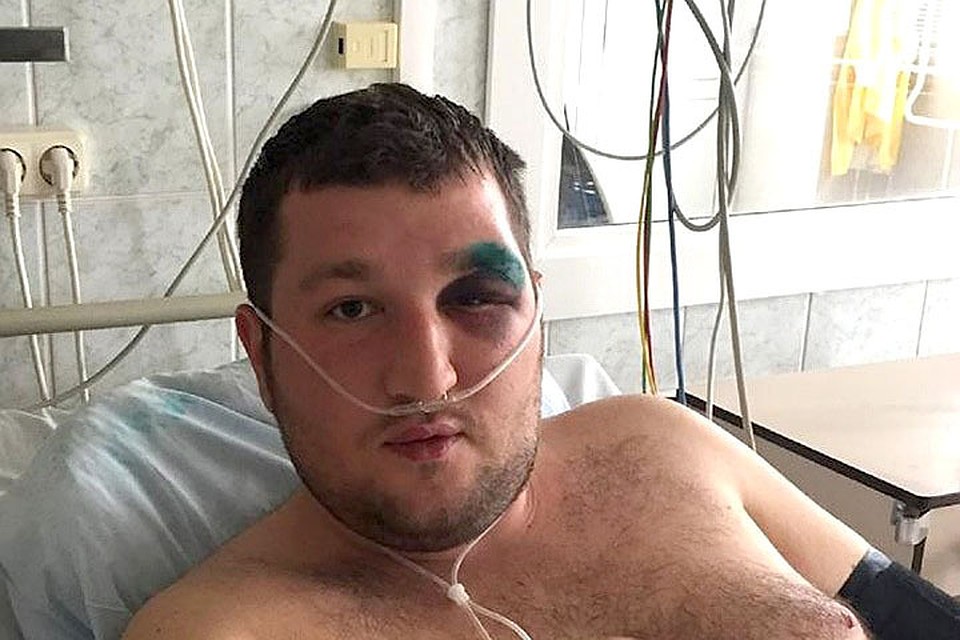 Один из потерпевших - Александр Зехов - попал в больницу с сотрясением мозга. Фото: Берасцейская вясна