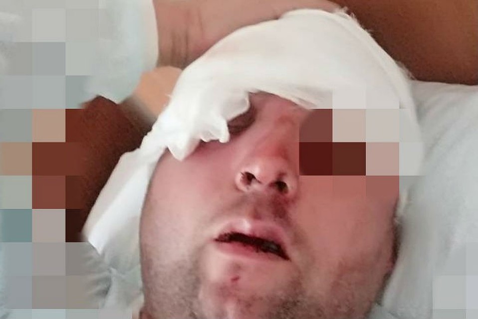 Павлу досталось больше всего. Он лежит в больнице. Фото предоставлено Светланой Коханюк.