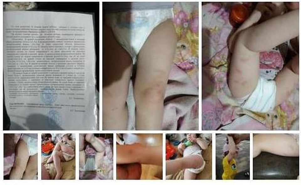 Следователи проверят омский садик, в котором няня якобы била ребенка