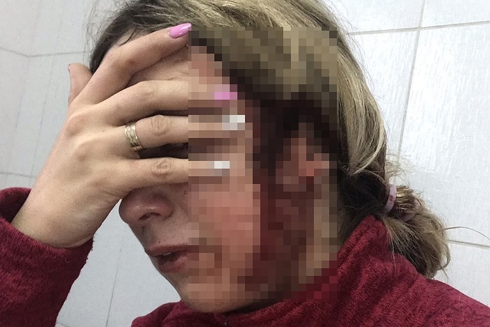 Скорая доставила пострадавшую в больницу, где ей наложили швы.