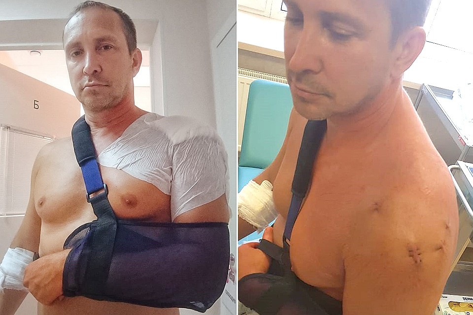 Вернувшись в Москву, артист сделал МРТ своей травмы.
