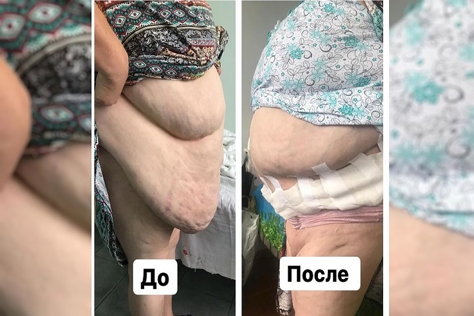 Фото: ГБУЗ "ММБ" МЗ КБР
