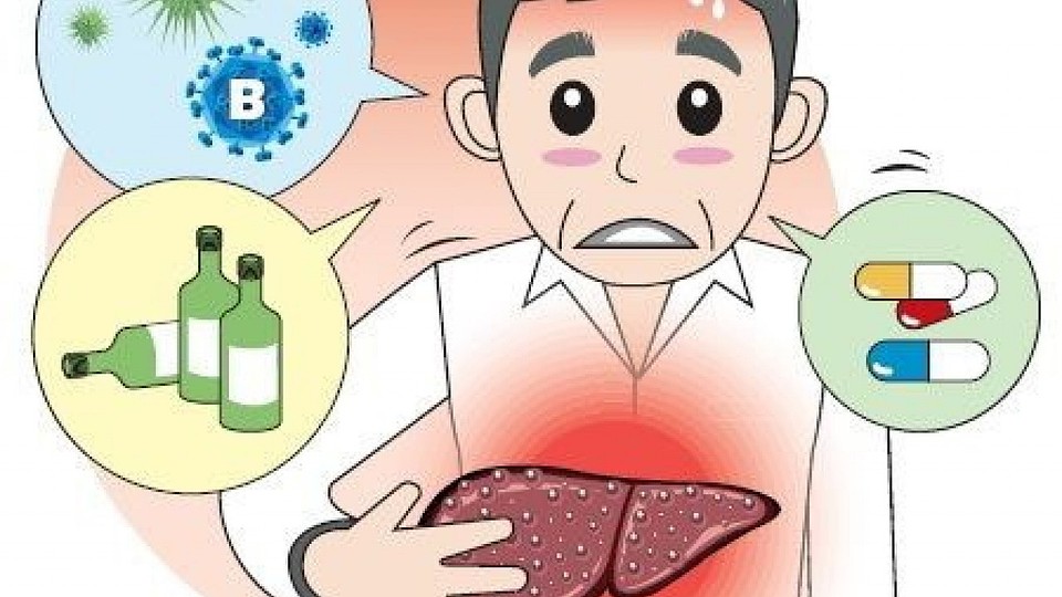 Гепатит – воспаление ткани печени из-за поражения ее вирусом, в результате чего нарушаются функции этого жизненно важного органа. Болезнь страшна своими последствиями, так как вызывает цирроз и рак печени.