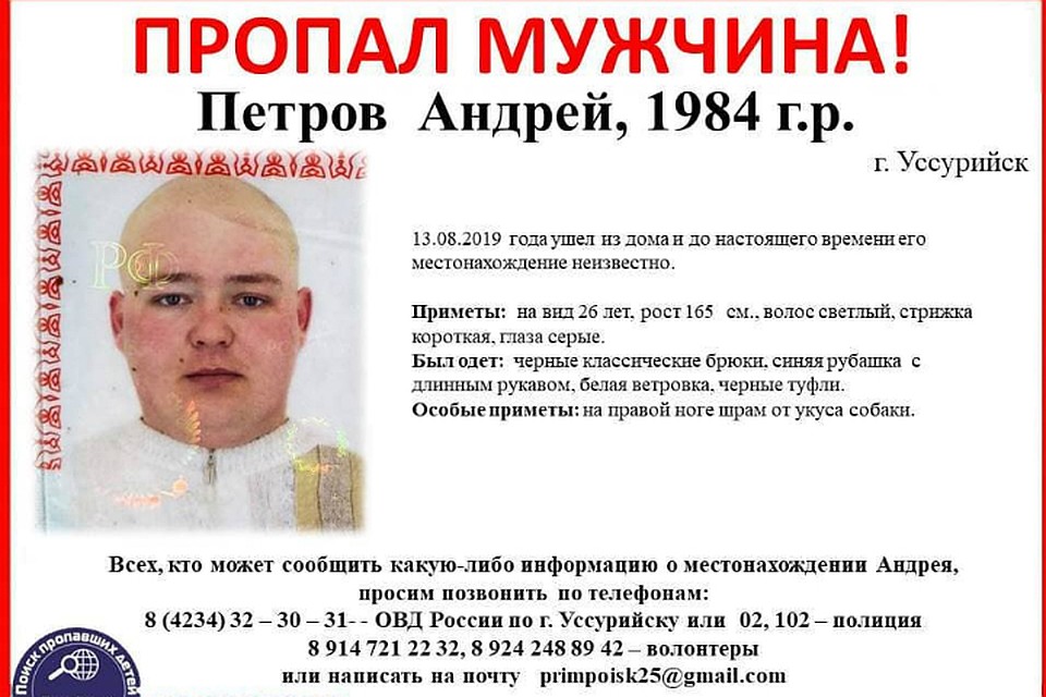 Среди особых примет мужчины - шрам от укусу собаки на правой ноге. Фото: primpoisk25