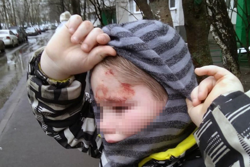 Что бы ни произошло в семье, но кровь на лице ребенка и следы побоев это повод, как минимум, для госпитализации и доследственной проверки