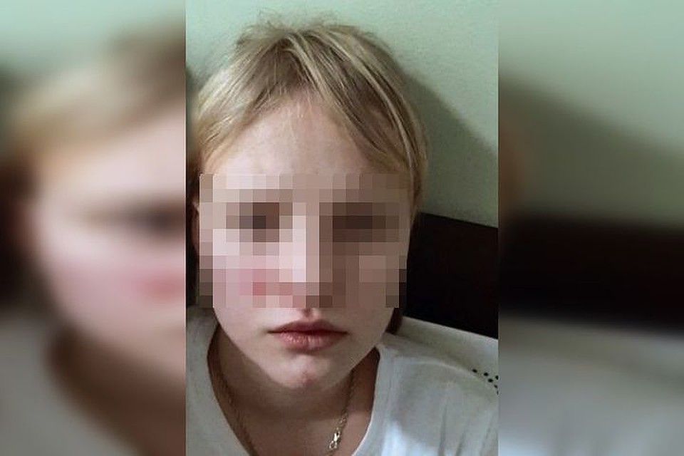 У девочки сотрясение головного мозга, синяки на теле и лице. Фото: личный архив.