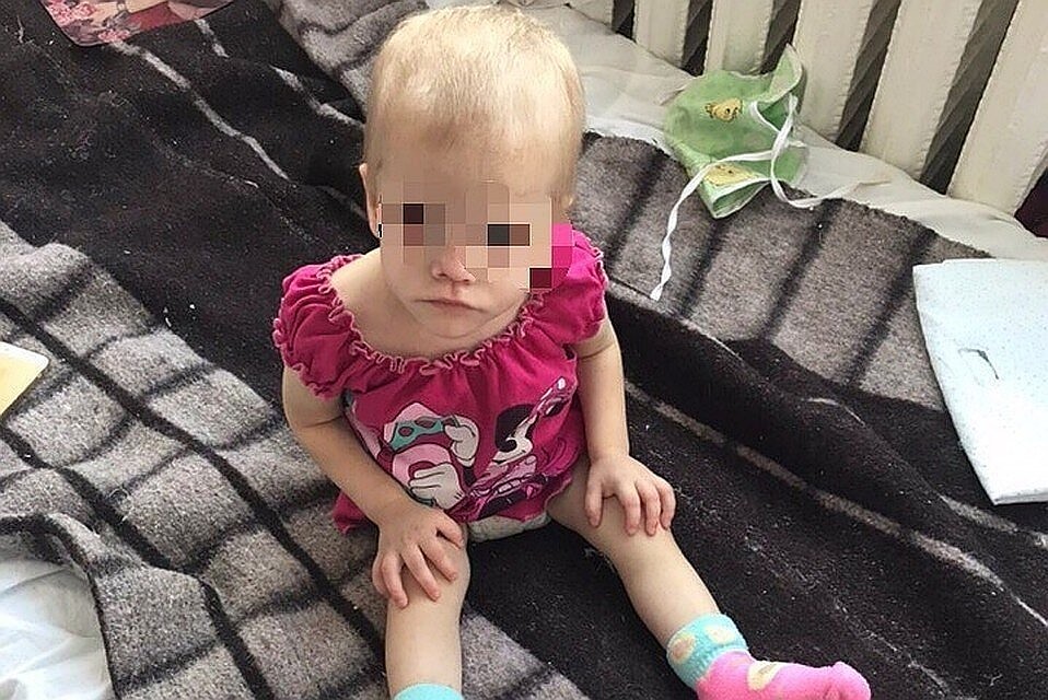 Малышка попала в больницу с травмой головы и истощением. Фото: предоставлено волонтерами