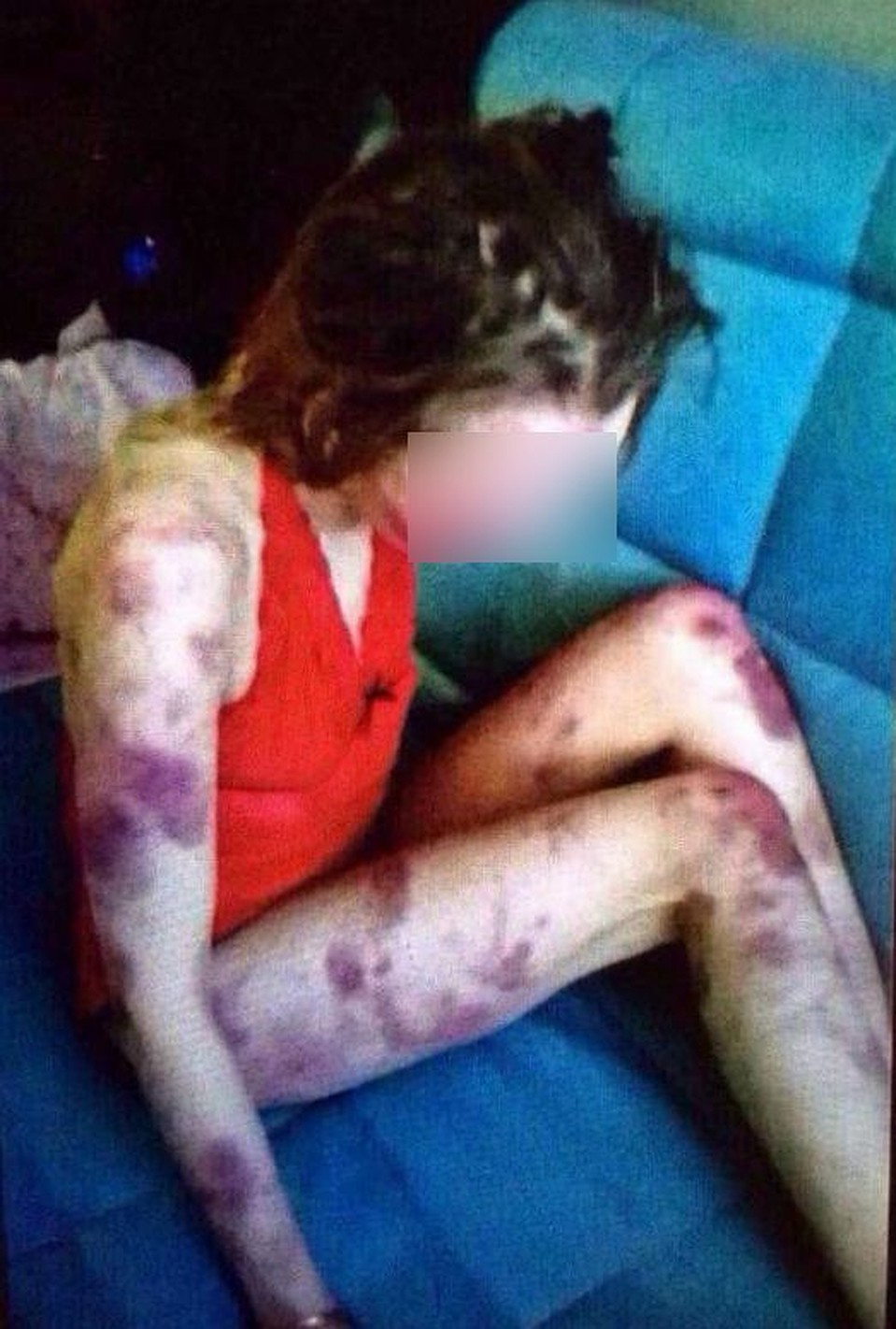 Избитая девушка скончалась в больнице Фото: Предоставлено очевидцем
