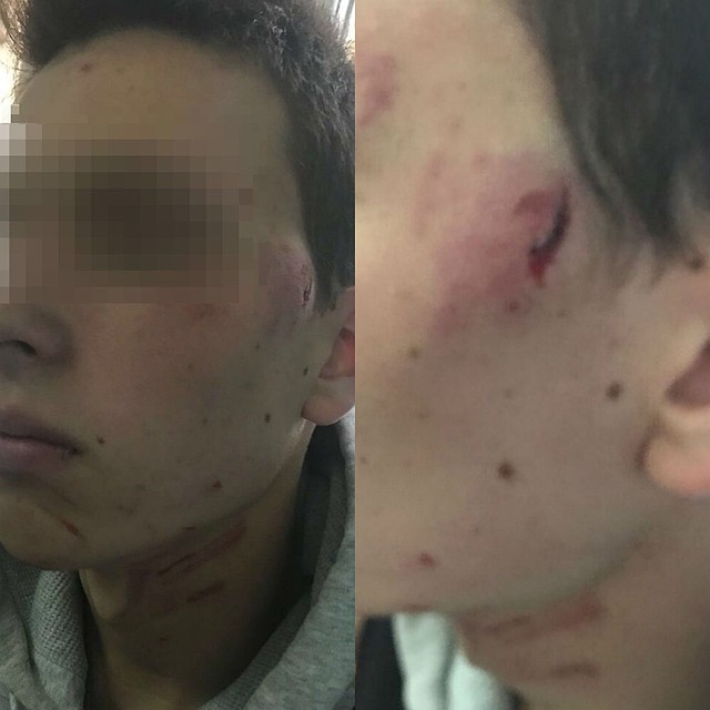 В таком состоянии был подросток после нападения отца Тимофея. Фото: родители пострадавшего
