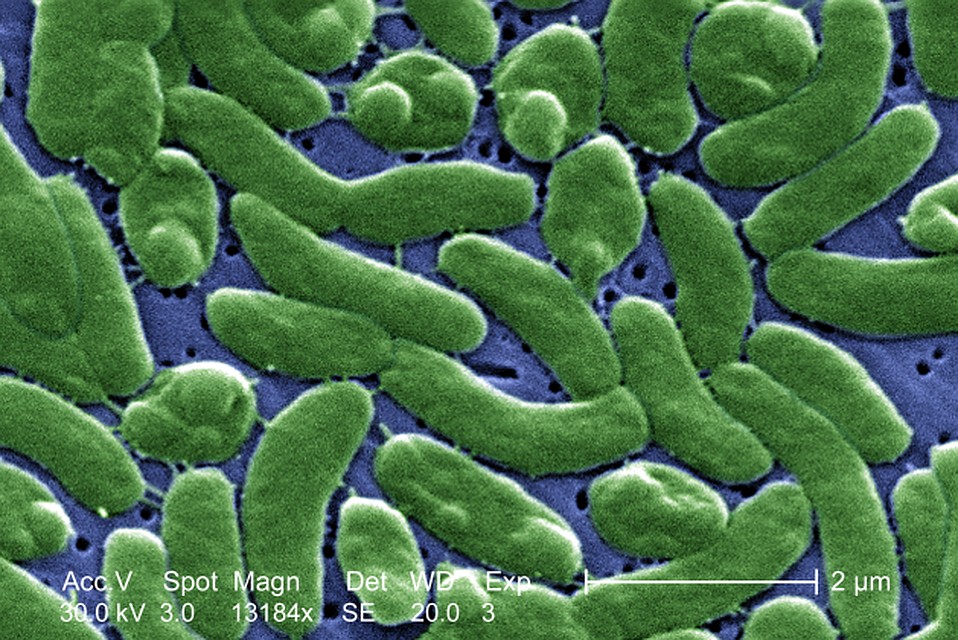 Vibrio vulnificus под микроскопом. Фото: GLOBAL LOOK PRESS