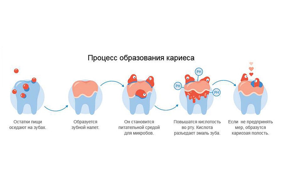 Не забывайте чистить зубы минимум два раза в день. Фото предоставлено пресс-службой ООО «АРКОМ».