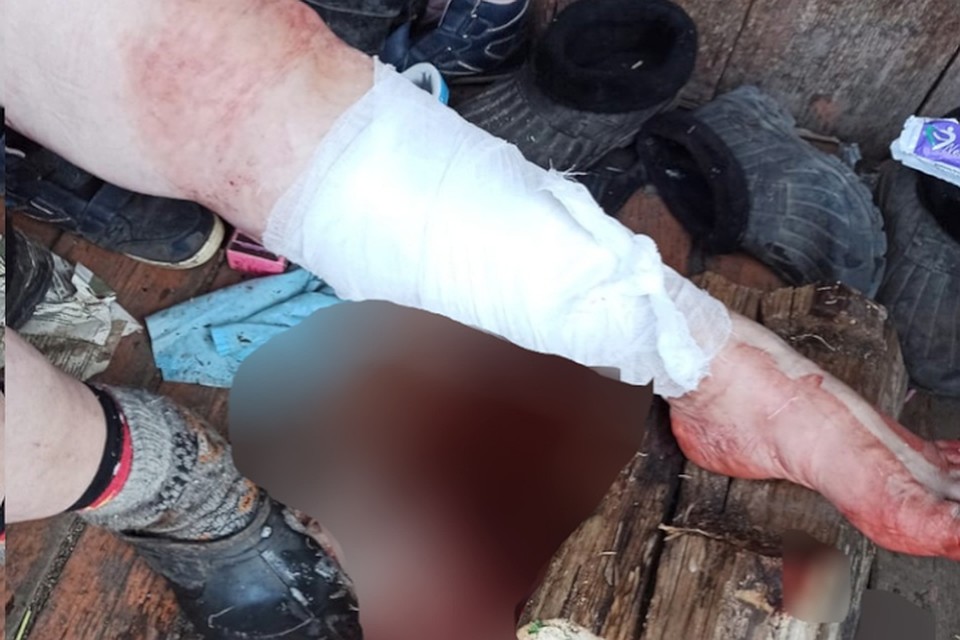 Бобр вцепился женщине в ногу