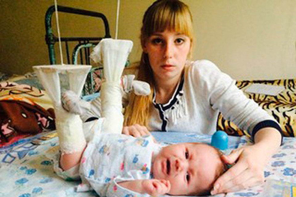 Двухмесячный Леша теперь в гипсе