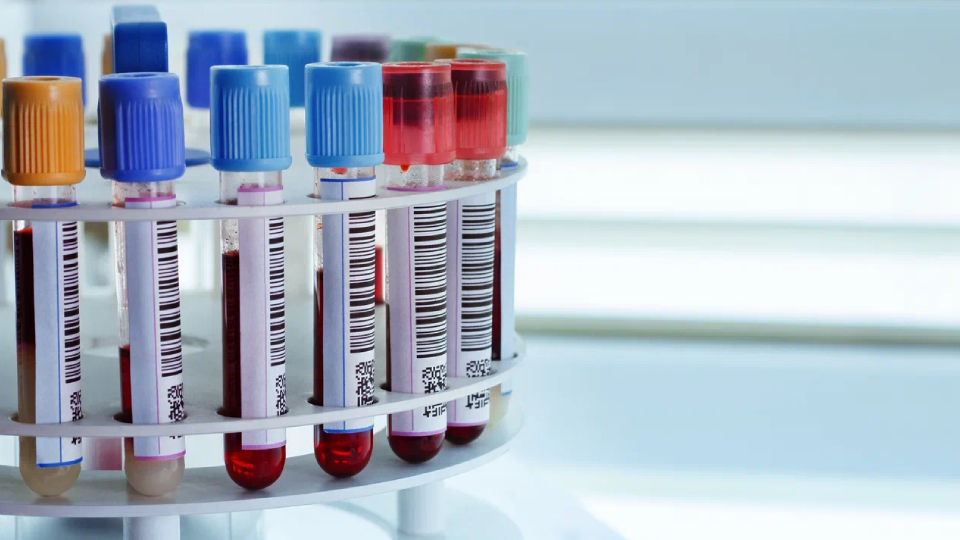 Аутоиммунный гепатит у взрослых