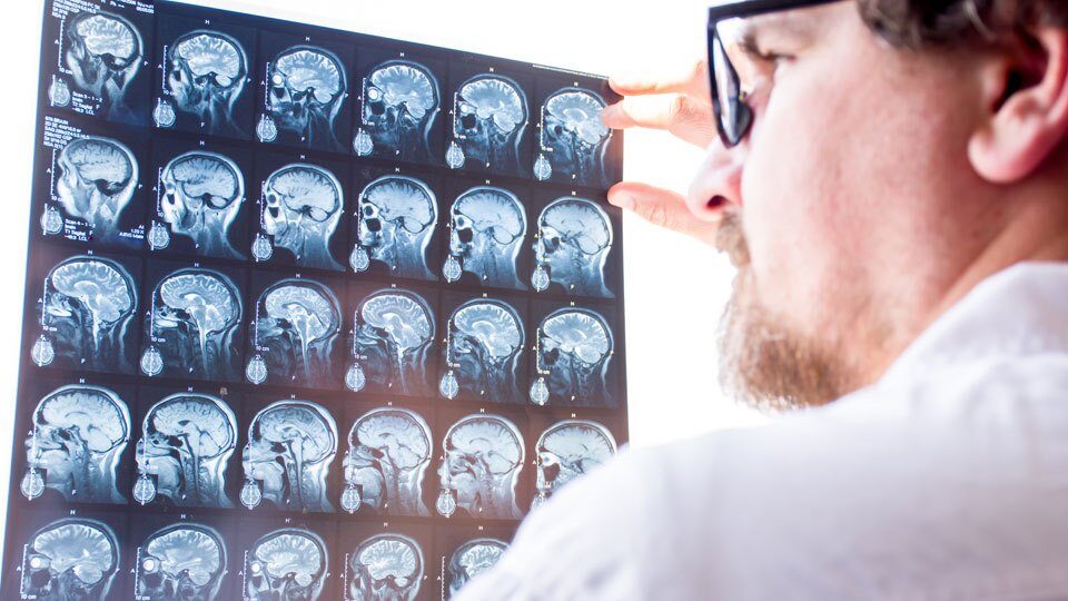 Отек головного мозга у взрослых