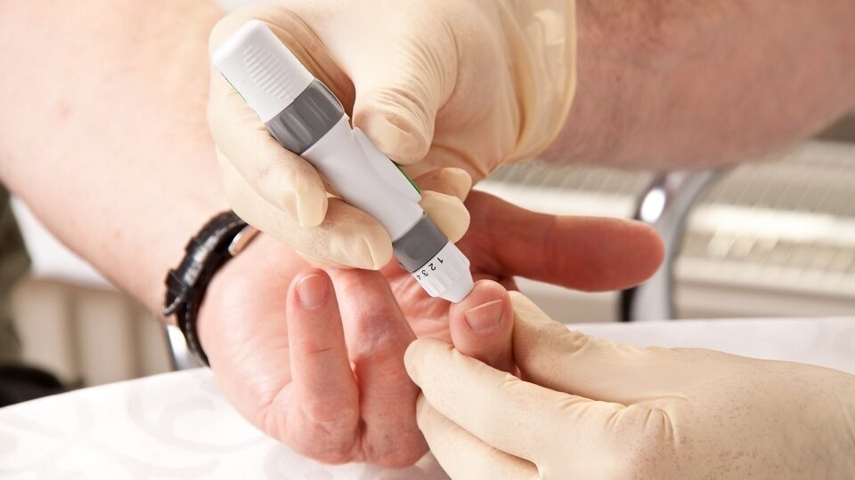 Диагностика сахарного диабета 2 типа