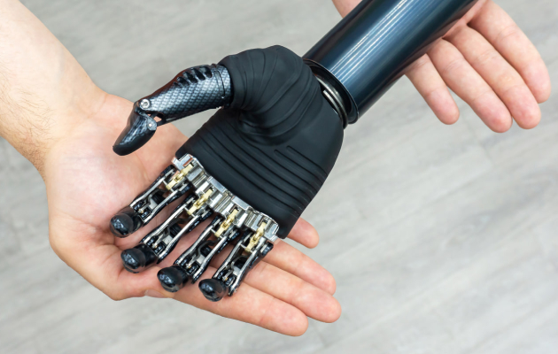 Протезы рук