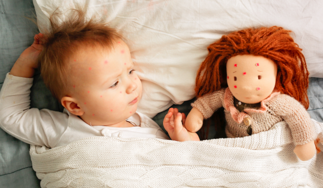 Фото, как выглядит стрептодермия у детей