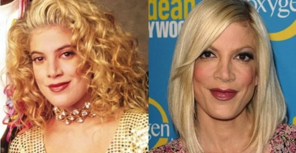 Четыре актрисы сериалов, которые потеряли карьеру после неудачных пластических операций