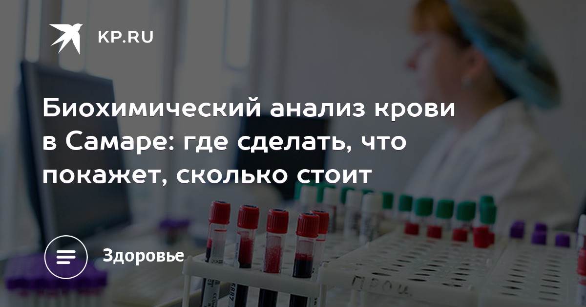 Сколько стоит общий анализ крови в самаре Медицинская справка для работы с гостайной Мякинино