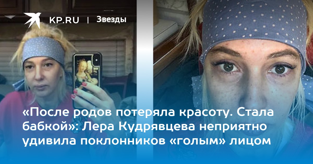 После родов потеряла красоту: Лера Кудрявцева неприятно удивила поклонников фото без макияжа рекомендации После родов потеряла красоту: Лера Кудрявцева неприятно удивила поклонников фото без макияжа рекомендации