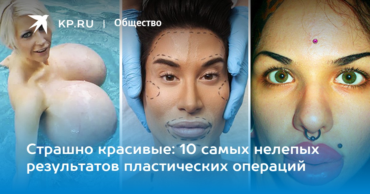 mne-sdelali-nerealno-krasivuyu-grud