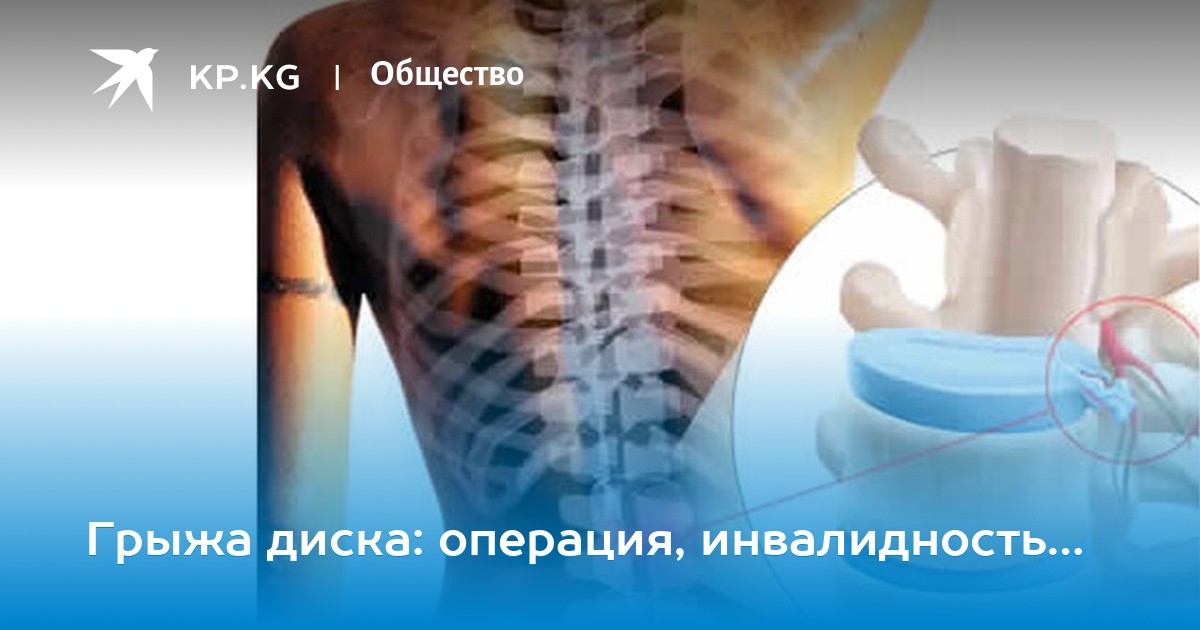 этом что-то инвалидность при распространенном остеохондрозе украина просто отличный, буду